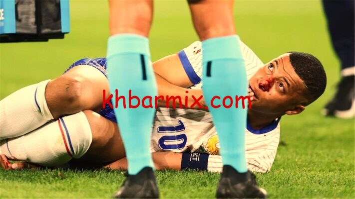 اصابة كيليان مبابي