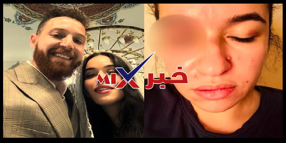 اعتداء محمود حجازي على زوجته