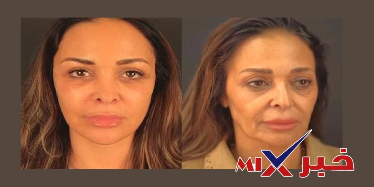 الفنانة داليا البحيري شد الوجه