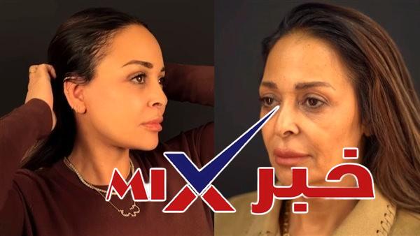 عملية-شد-الوجه-العميق-داليا-البحيري كم تكلفة عملية الفنانة داليا البحيري شد الوجه والرقبة 2026 .. اليك كل التفاصيل التي أثارت إعجاب رواد التواصل