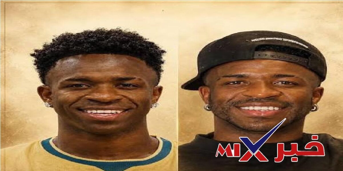 فينيسيوس جونيور عملية التجميل