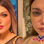 ما هو مرض ياسمين الخطيب؟