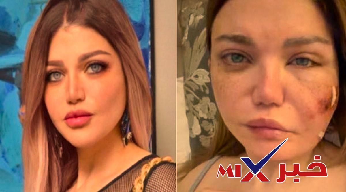 ما هو مرض ياسمين الخطيب؟