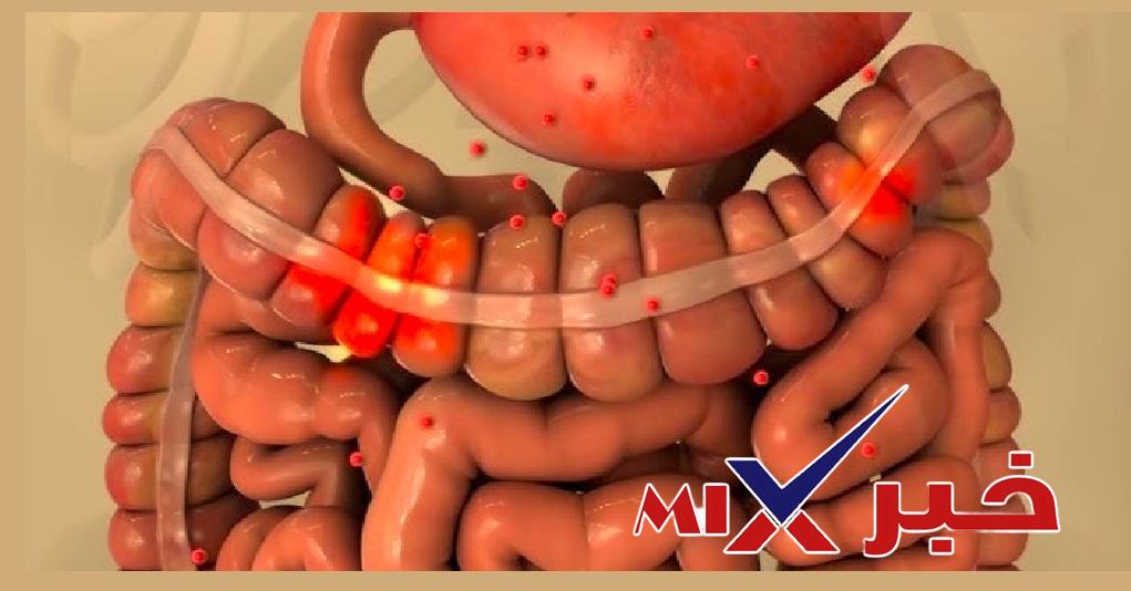 ماذا-يأكل-مريض-التلبك-المعوي؟ نصائح ذهبية لتجنب التلبك المعوي في عيد الفطر 2026: دليل شامل لصحة جهازك الهضمي